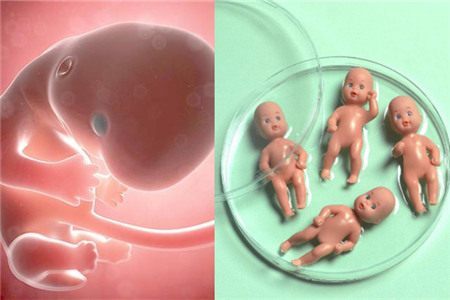 靠谱孕妈供卵代孕包生儿子